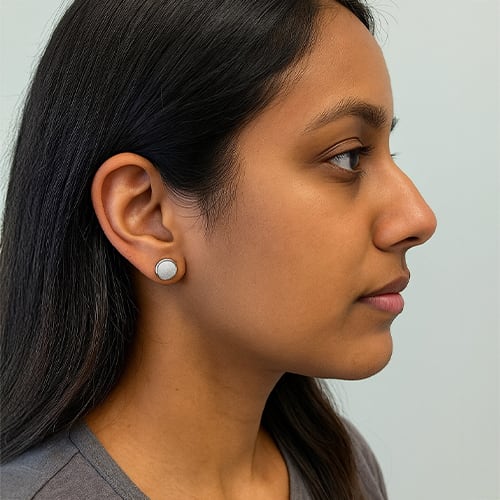 Virtual Consultation Smile Image Example - Profile Portrait